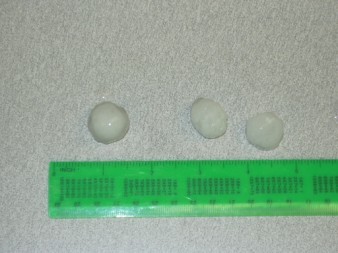 Penny sized Hail in East Milford, NH photo provided by N1MEO-Fletcher Seagroves